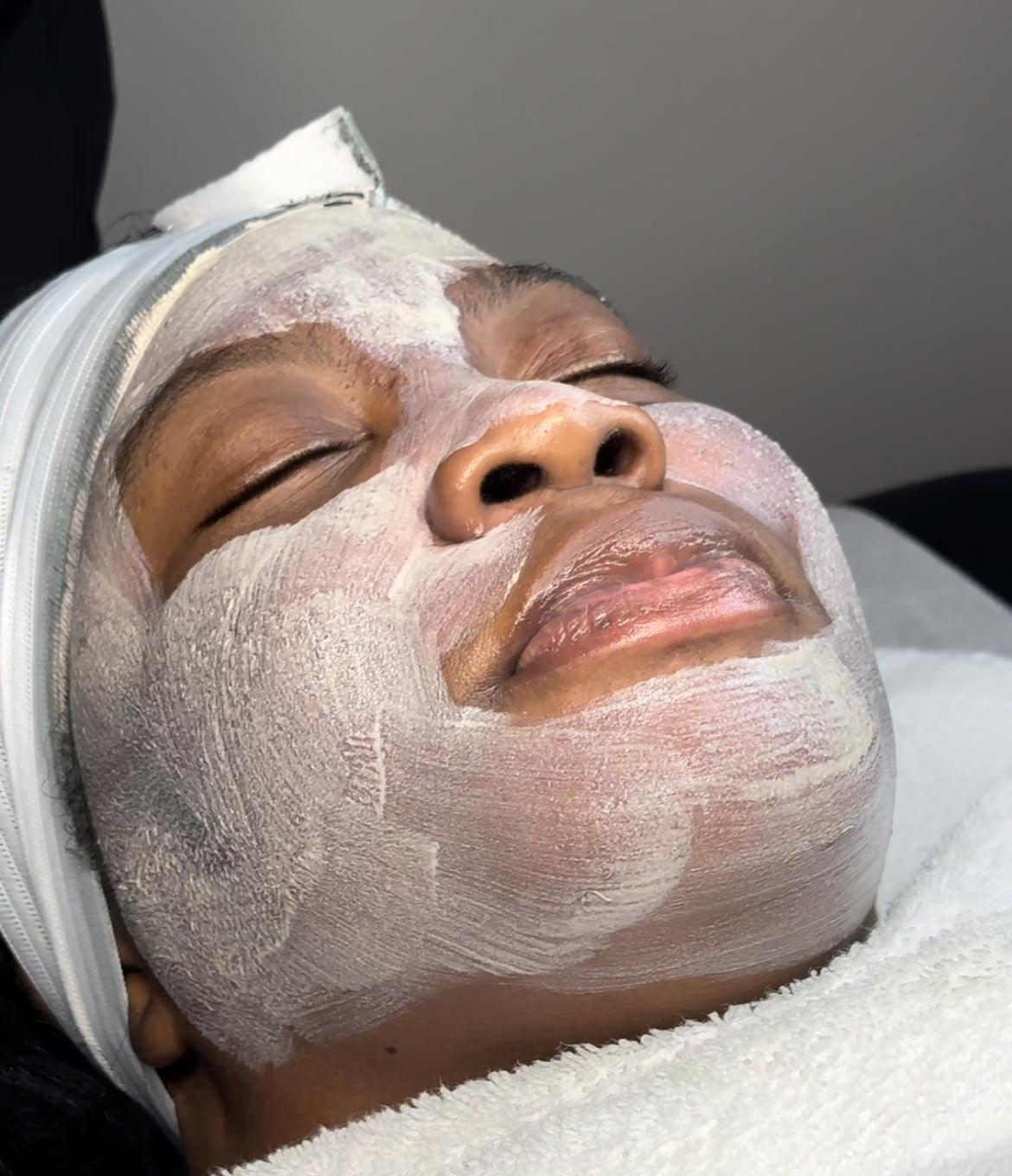 CysticRx Mask